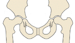 Orthopaedic Pelvic Hip Image