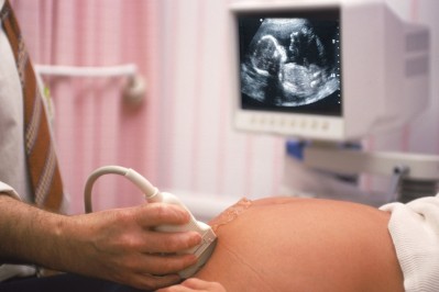 CRH Pregnancy Scan.jpg